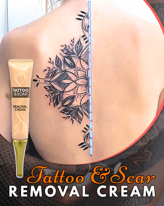 Tattoo & Scar Removal Cream