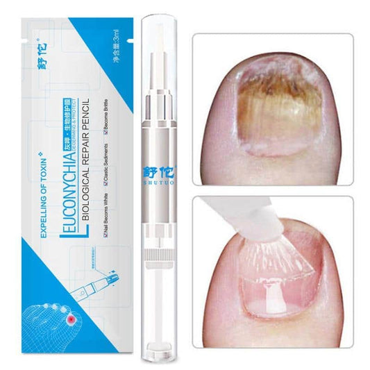 Fungus Nail Repair Pen Toenail Nail Care Treatment