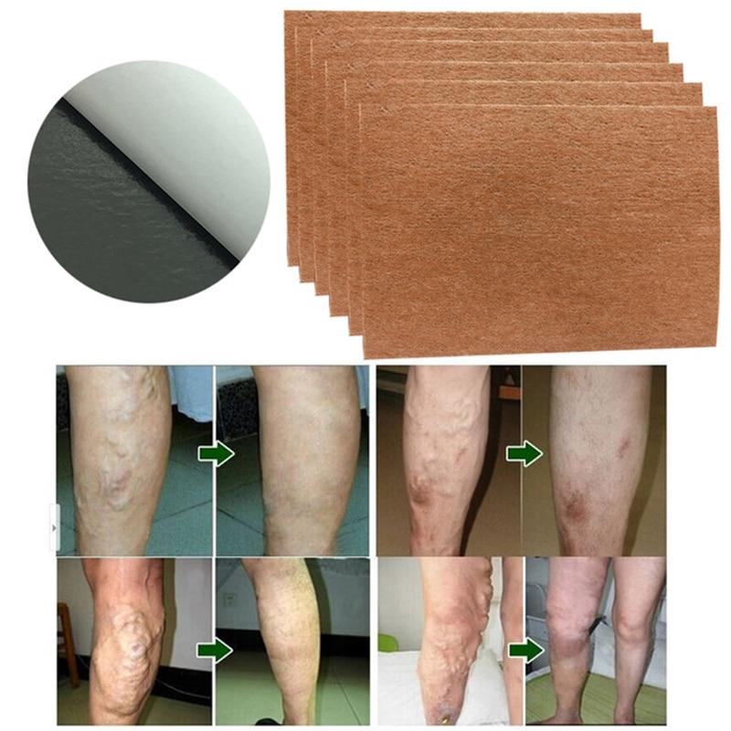 Varicose Veins Herbal Healing Patch