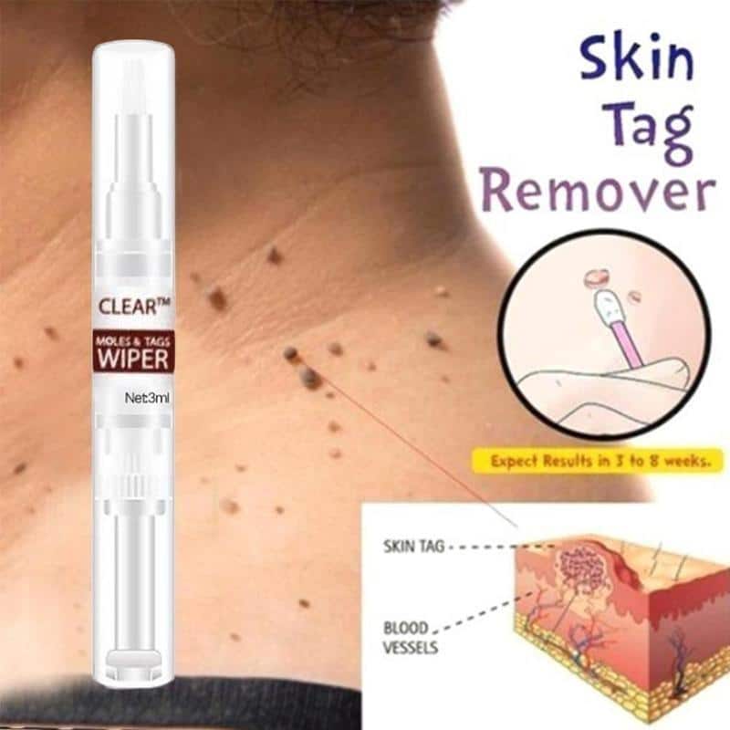 Clear™ Moles & Tag Wiper