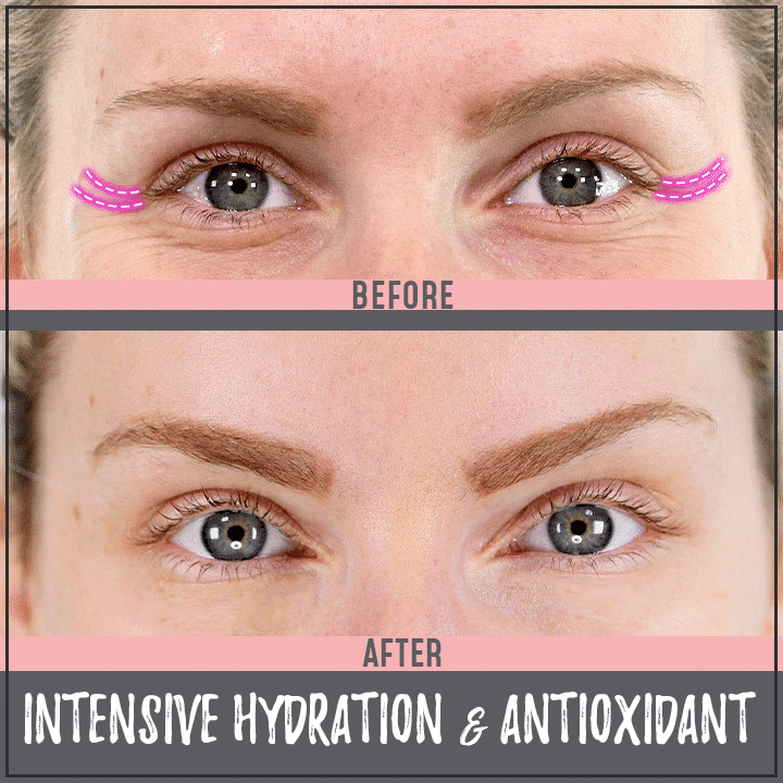 Anti-aging Depuff Eye Pads