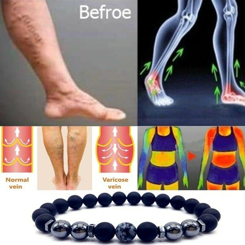 Anti-Swelling Black Obsidian Anklet