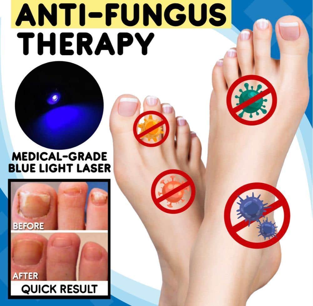 Fungal-out Blue Light Treatment Set