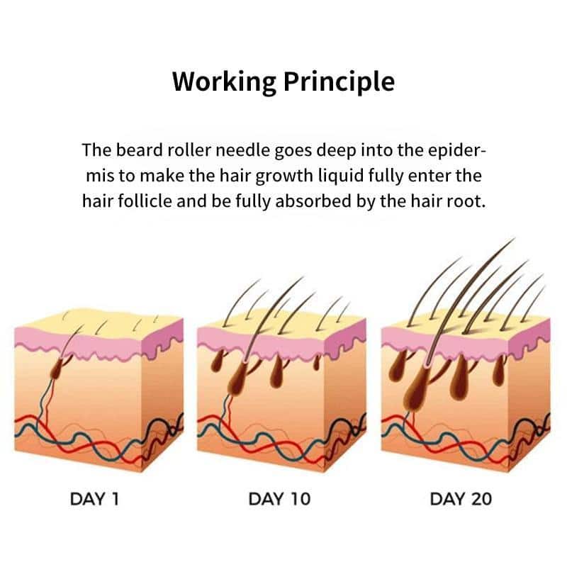 Beard Growth Roller Set