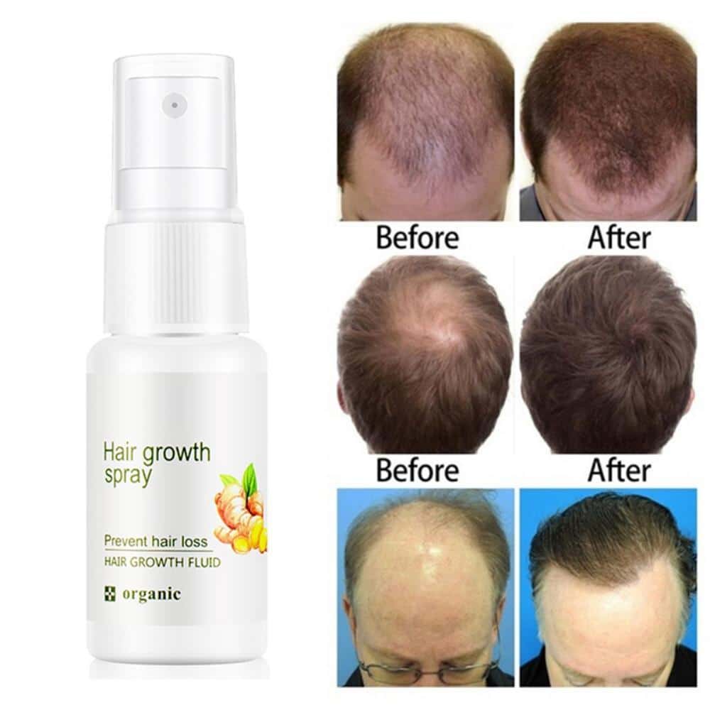 ReGrowth Ginger Spray