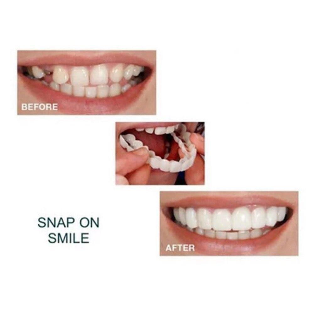 Tooth covers for a perfect smile