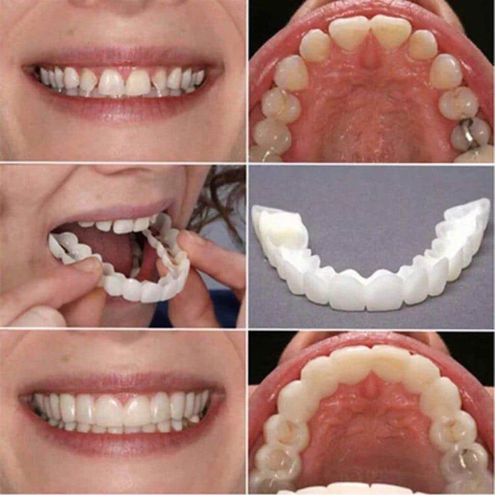 Tooth covers for a perfect smile