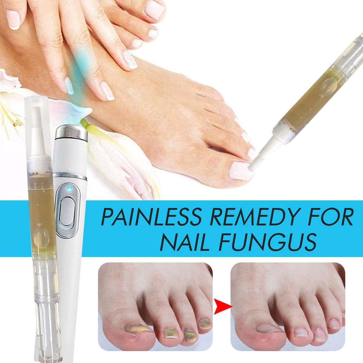 Anti-Fungal Home Treatment Set